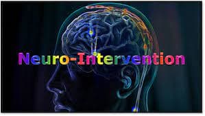 Intervention Neurology